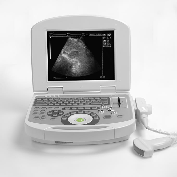 Portable Ultrasound Machine